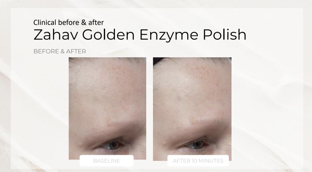 Zahav Golden Enzyme Polish – product details, medical-grade skincare by Zahav Medspa